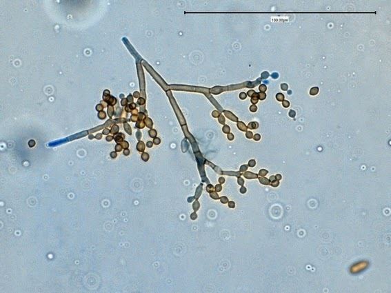 Cladosporium Fun With Microbiology What39s Buggin39 You Cladosporium species