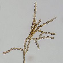 Cladosporium cladosporioides httpsuploadwikimediaorgwikipediacommonsthu