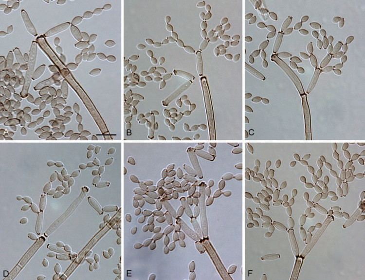 Cladosporium cladosporioides Cladosporium cladosporioides CBS 112388 AF Macronematous