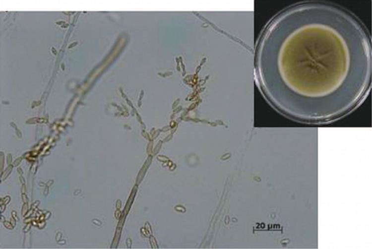 Cladosporium cladosporioides Cladosporium cladosporioides Cladosporium is a common fungus