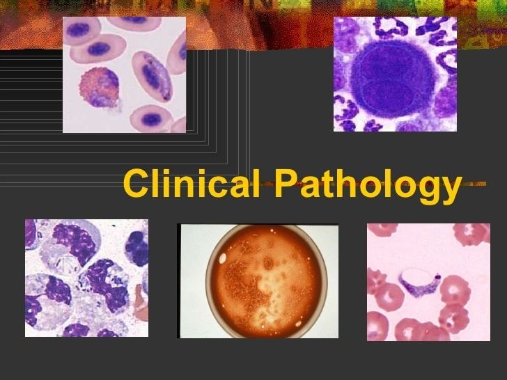 Clinical pathology httpsimageslidesharecdncom04clinicalpatholog