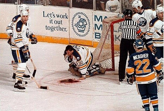 Clint Malarchuk Clint Malarchuk almost bled to death when his throat was