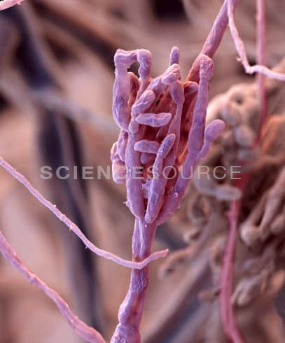 Clonostachys rosea f. rosea Clonostachys rosea f rosea SEM Stock Photo BP3025 Science