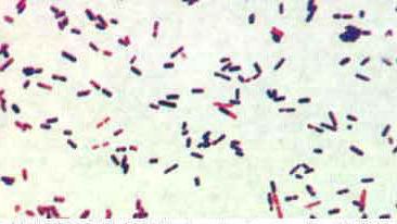 Clostridium Pathogenic Clostridia Including Botulism and Tetanus