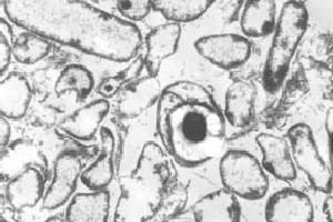 Clostridium acetobutylicum Clostridium acetobutylicum MicrobeWiki