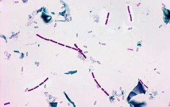 Clostridium bifermentans microbecanvascomadminuploadsimagebacterienc