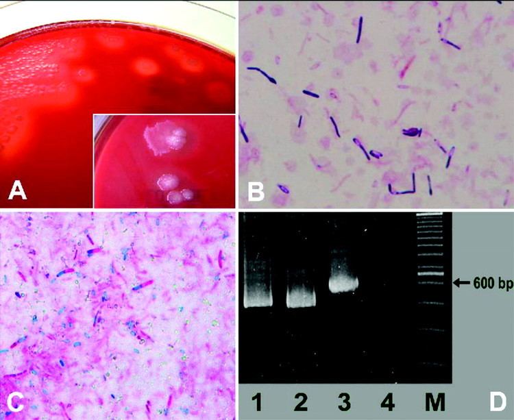 Clostridium chauvoei jcmasmorgcontent4641545F2largejpg