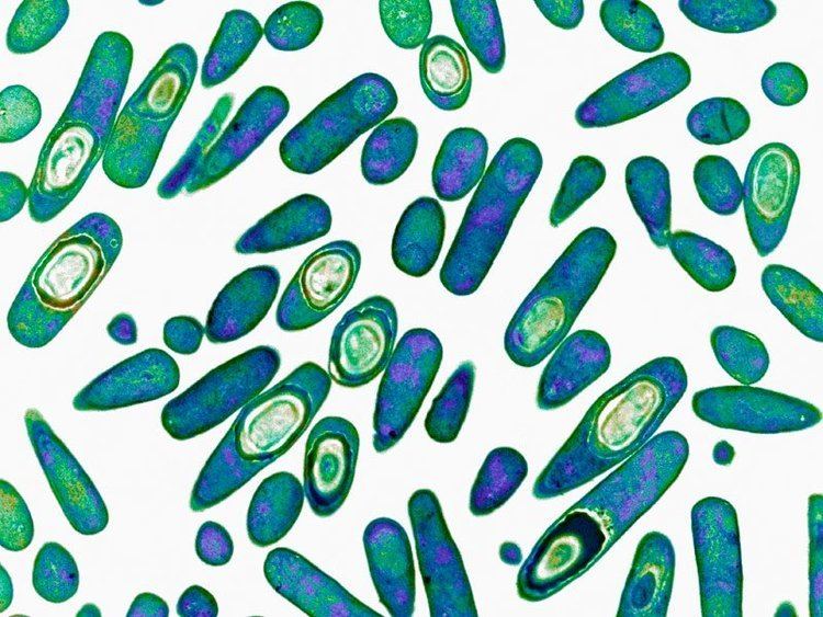 Clostridium difficile (bacteria) Molecular Tests Linked to C difficile Overdiagnosis