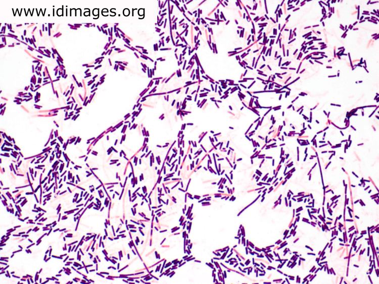 Clostridium Clostridium Images Partners Infectious Disease Images eMicrobes