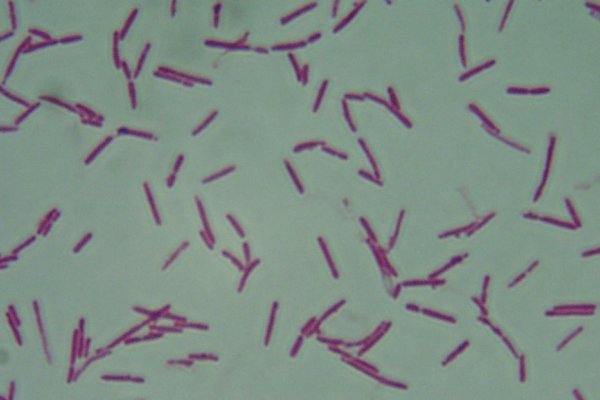 Clostridium novyi Clostridium
