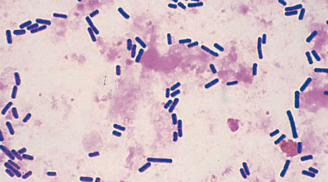 Clostridium perfringens as seen when viewed under a microscope.