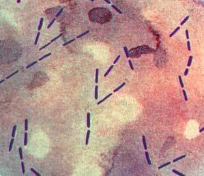 Clostridium perfringens as seen when viewed under a microscope.