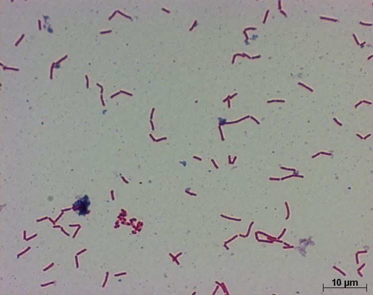 Clostridium ramosum httpsidwonlinededenewsimageid246236ampsize