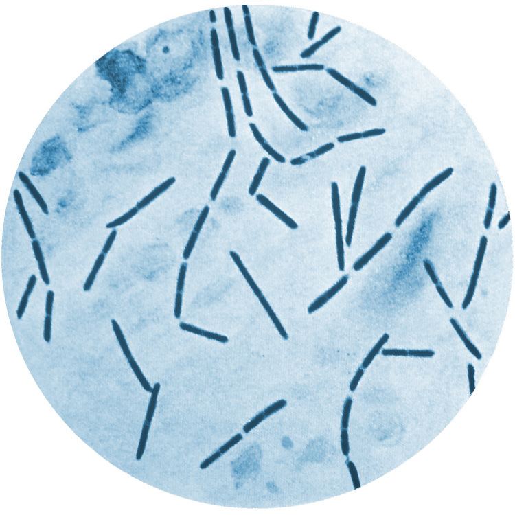 Clostridium septicum PoultryDVM Pathogens AZ Clostridium septicum