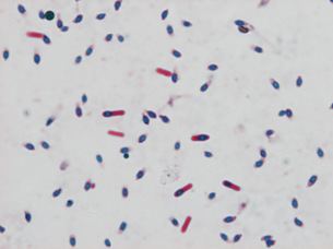 Clostridium septicum Bodies CE Pathological and nonpathological bodies