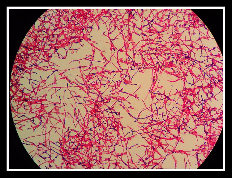 Clostridium septicum C septicum Gram stain by Weazler on DeviantArt