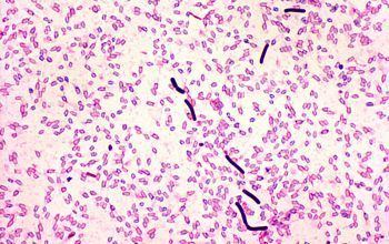 Clostridium sordellii Clostridium sordellii