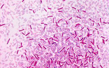Clostridium sordellii Clostridium sordellii