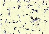 Clostridium sordellii httpswwwcdcgovhaiimagesclostridiumsordell