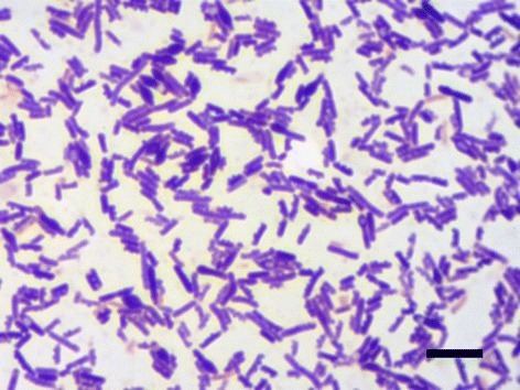 Clostridium sporogenes ~ Everything You Need to Know with Photos | Videos