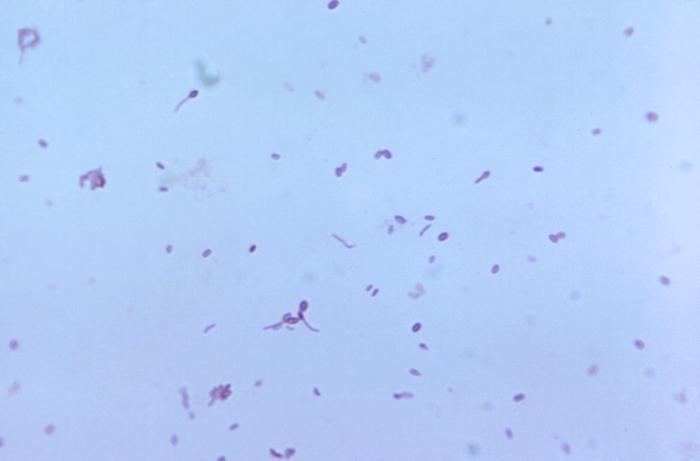 Clostridium tertium httpsuploadwikimediaorgwikipediacommons88