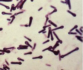 Gram stain of Clostridium tetani