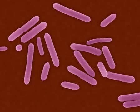 Clostridium tetani are rod-shaped bacteria (Kunkel)
