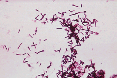 Tetanus bacteria