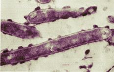 Clostridium thermocellum genomejgidoegovclothclothjpg