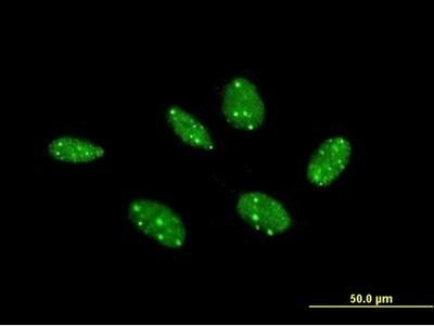 Coilin AntiCoilin antibody ab167253 Abcam