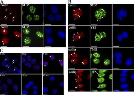 Coilin The subnuclear distribution of coilin and SC35 is affec Openi