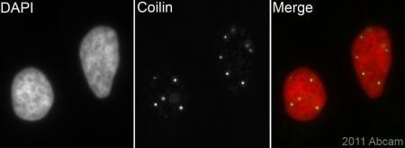 Coilin AntiCoilin antibody IH10 ab87913 Abcam