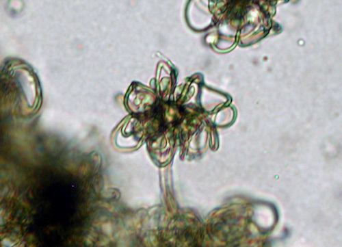Cokeromyces recurvatus zygomycetesorgimages104jpg