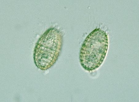 Coleps Protist Images Coleps hirtus