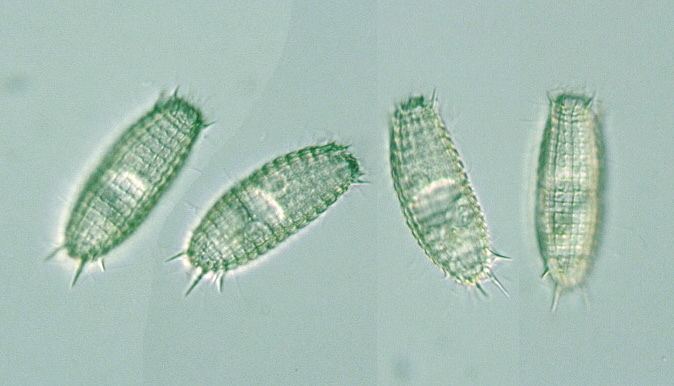 Coleps Protist Images Coleps incurvus