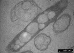 Comamonas acidovorans Biodegradation of PHA Ecobiomaterial