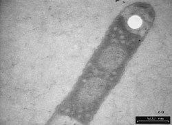 Comamonas acidovorans Biodegradation of PHA Ecobiomaterial