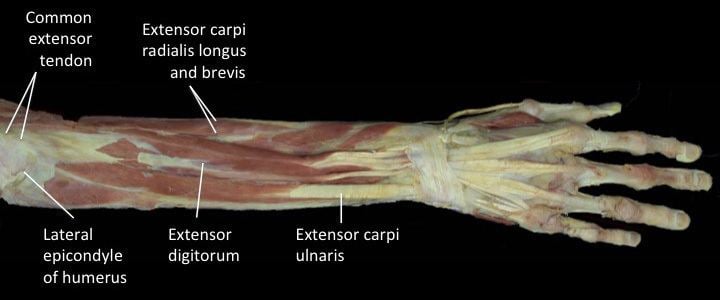 Common extensor tendon
