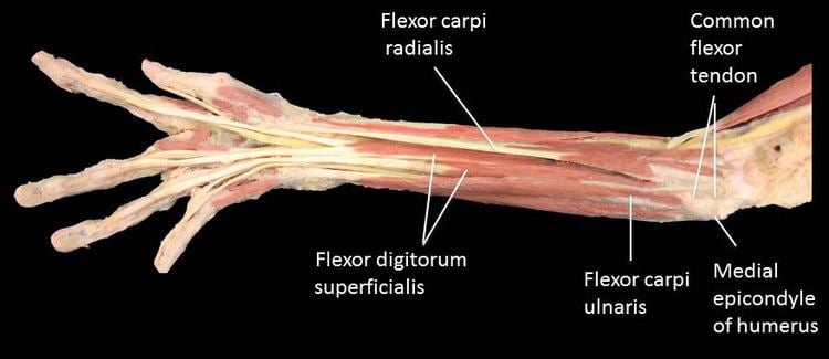 Common flexor tendon