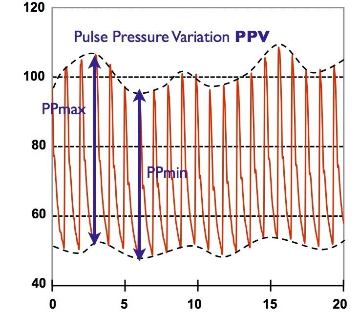 Continuous noninvasive arterial pressure