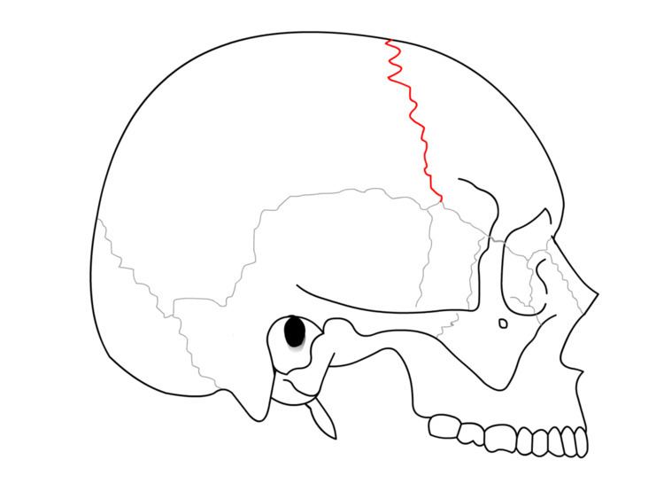 Coronal suture