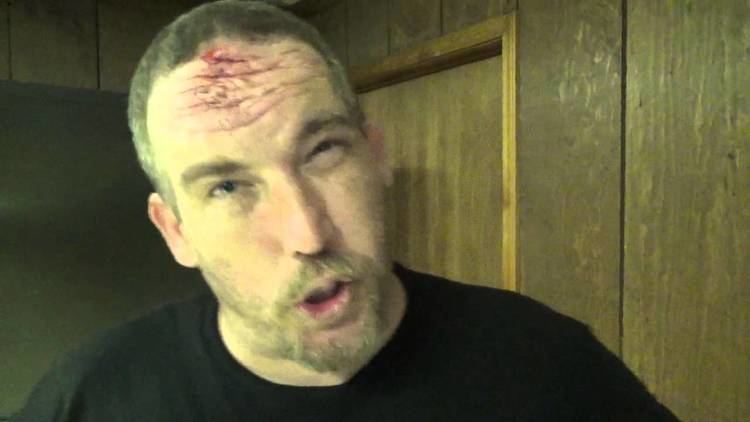 Corporal Robinson CORPORAL ROBINSON speaks on flaming no rope barbwire match vs JOHN