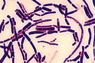 Corynebacterium matruchotii microbiologyscuedutwMIBmicrobacteriapicture