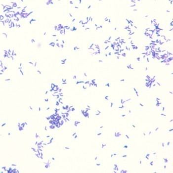Corynebacterium renale atlassundkudkmicroatlasveterinarybacteriaCo