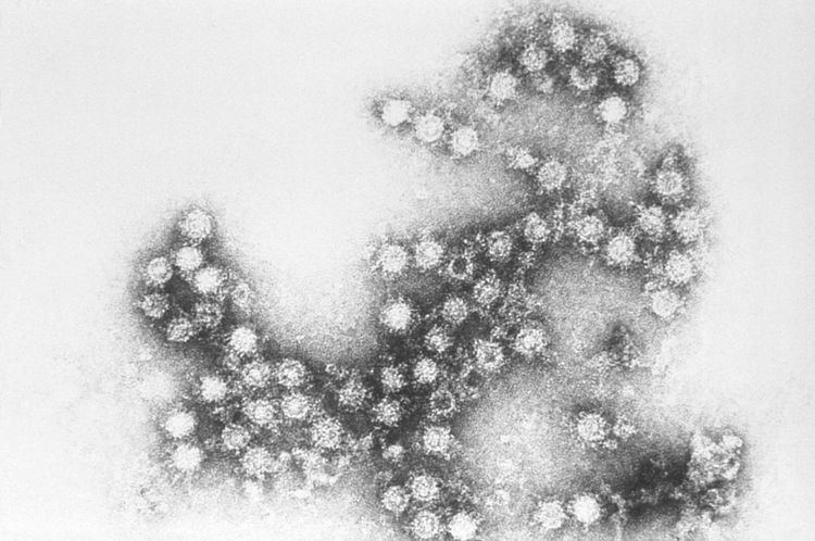 Coxsackie B4 virus