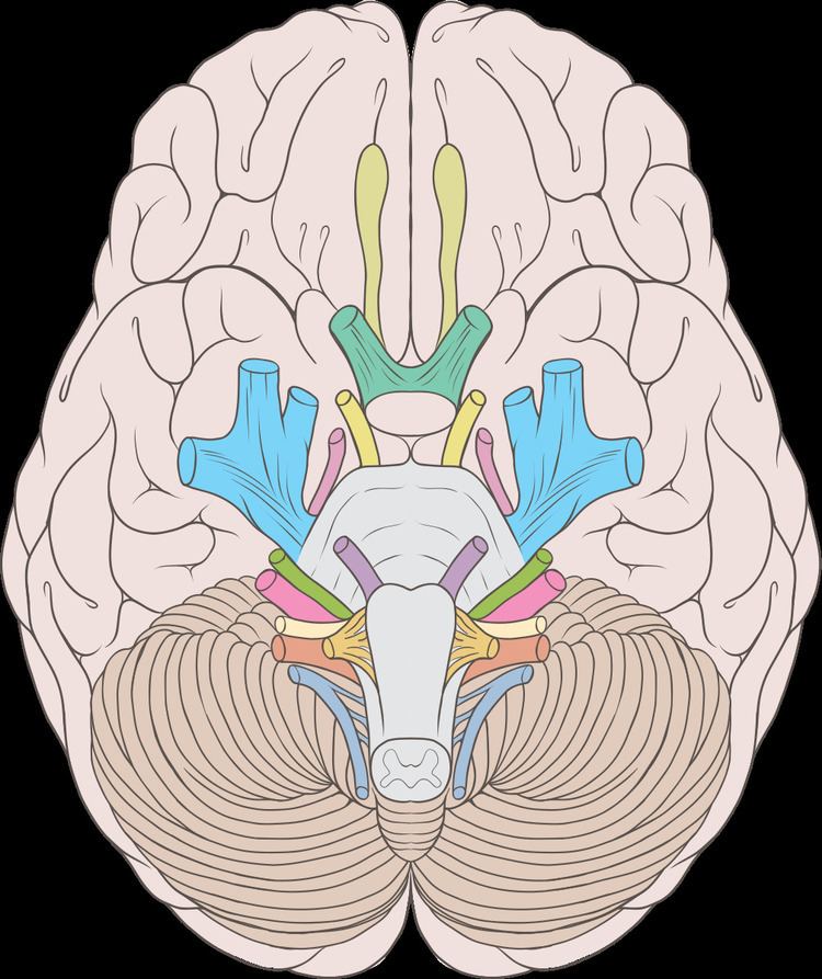 Cranial nerve disease