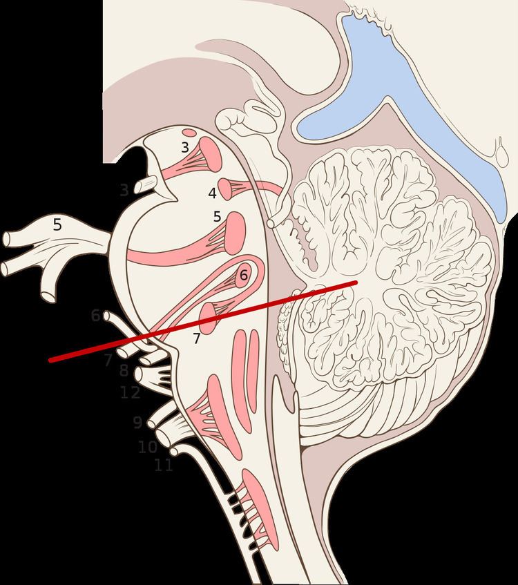 Cranial root of accessory nerves