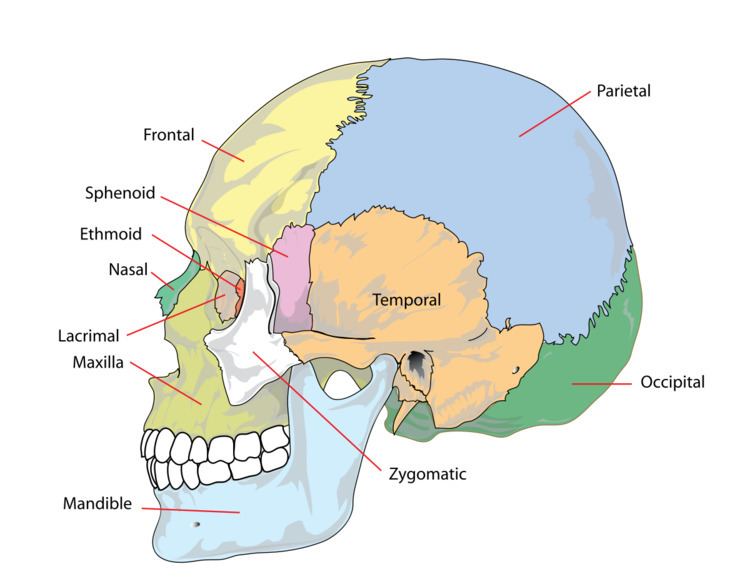 Craniofacial abnormality