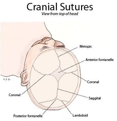 Craniofacial surgery