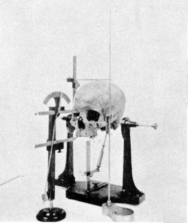 Craniometry